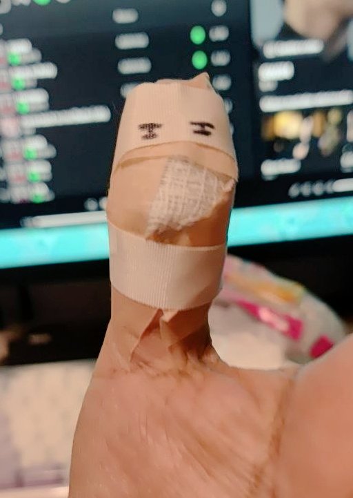 Me arranque un pedazo de la huella dactilar del pulgar por accidente con un seguro que se cerro en mi dedo y duele usarlo. 

La Elli : "Ahora es un ninja" -me raya el dedo-