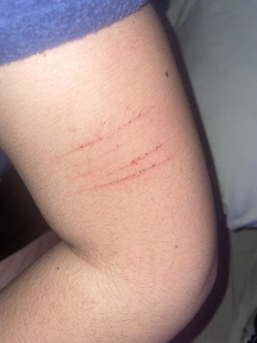 maddy ferguson of shedtwt ꩜ tweet media