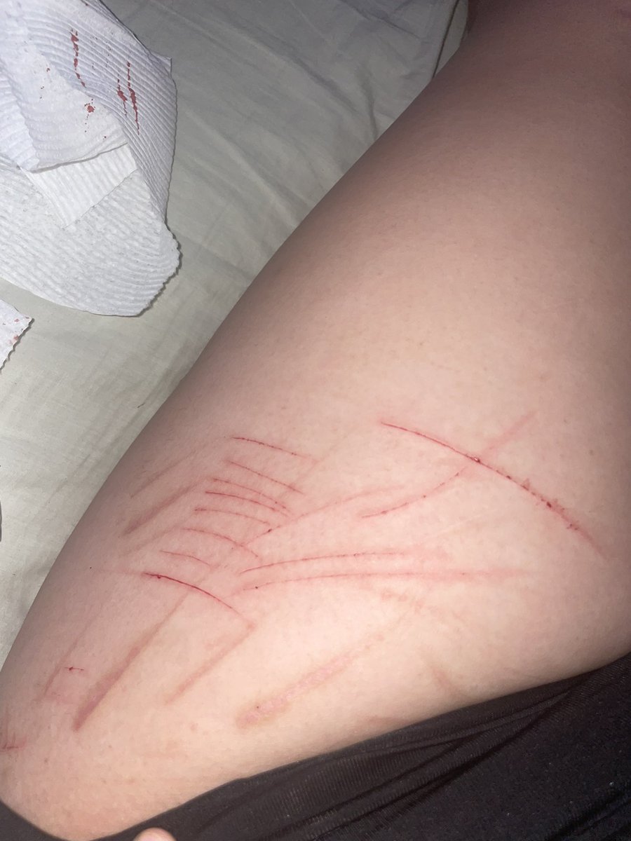 maddy ferguson of shedtwt ꩜ tweet media