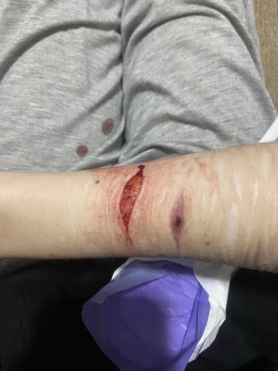 🫧Bubbles of shedtwt🪽 tweet media