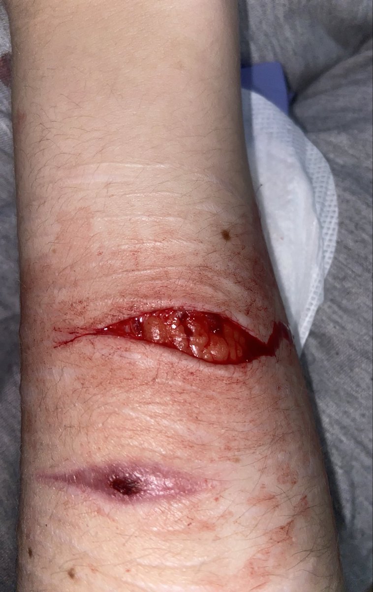 🫧Bubbles of shedtwt🪽 tweet media