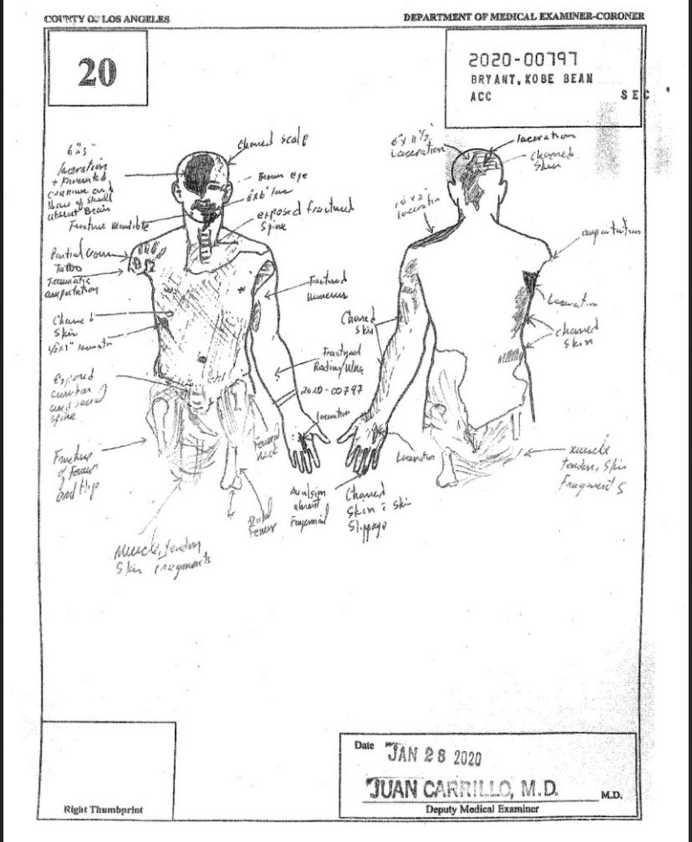 JeffHafleysBallCleaner tweet media