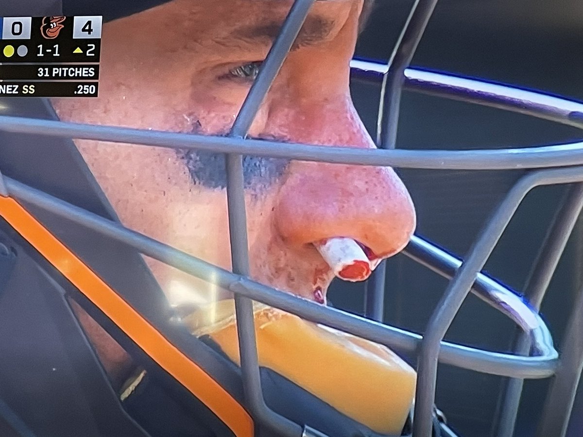 Chris Li tweet media