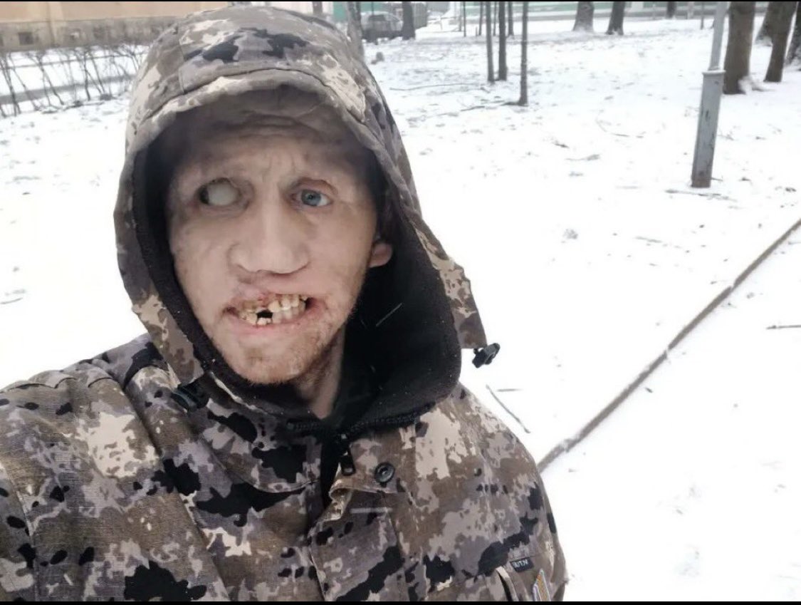 Laurentiu🇪🇺 tweet media