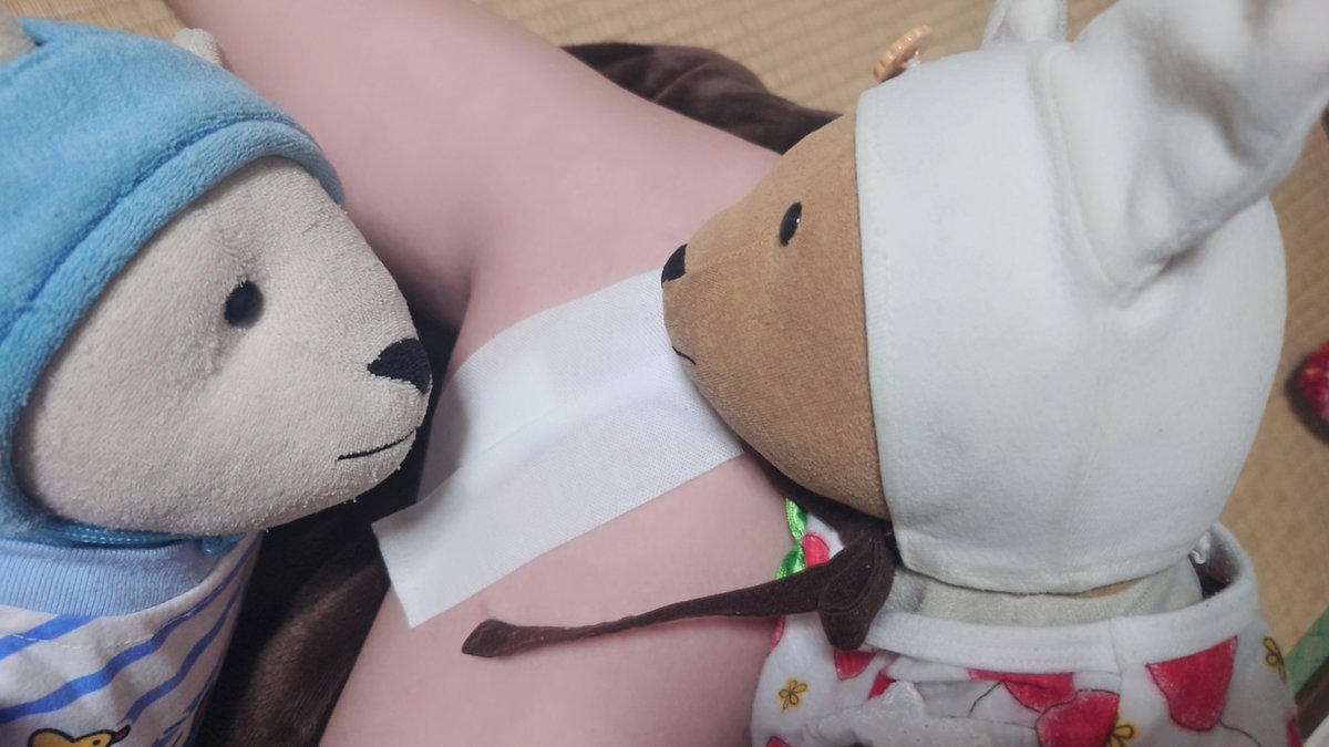 手術してきた〜
どうせ腫瘍は見れないんだろうな…と思ってたら術後に看護師さんが「摘出したもの見ますか？」と言ってくれて思わず、「え！良いんですかぁ♡」とにこにこしてしまいました。

今日も元気です！！！
心配してくれるくまたち