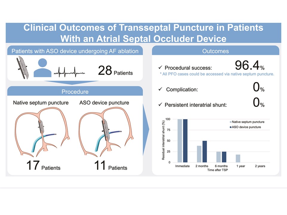 ESC_Journals's tweet image. 📌 Transseptal Puncture and Catheter Ablation of #AF in Patients With Atrial Septal Occluder Devices: Procedural Techniques and Outcomes
💡 ow.ly/5Pm750YJ97n

@EuropaceEiC @GiulioConteMD @Dominik_Linz @FraSantoroMD @AndyZhangMD @marcovitoloMD @DavideMei93 #Europace