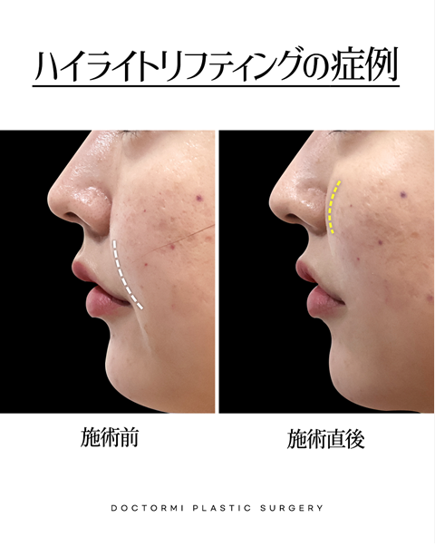 ドクター美整形外科 tweet media