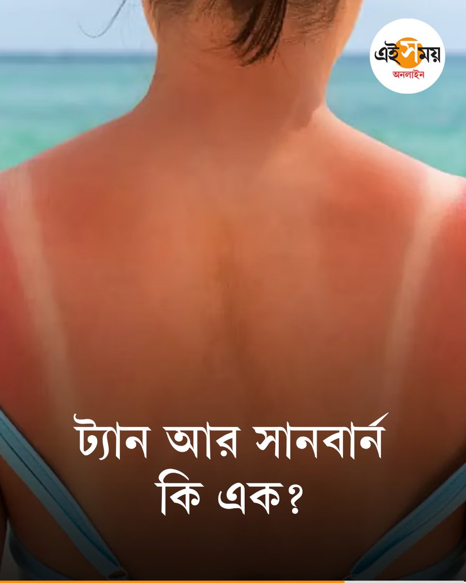 Ei_Samay's tweet image. রোদে পোড়া ত্বকের পার্থক্য চিনে নিন
👉 eisamay.com/lifestyle/beau…

#eisamayonline #EiSamay