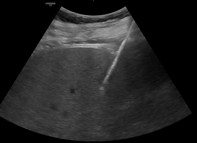 CIRSE European Trainee Forum tweet media