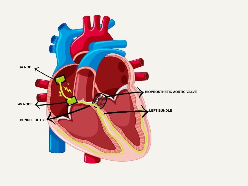 Reviews in Cardiovascular Medicine tweet media