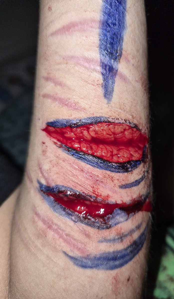 Astros_mind's tweet photo. First post! Progress! :) 
Deep beans?🤔

#shtwt #shedtwt #slittwt #beanstwt #beanshtwt #988twt #selfharm #sh https://t.co/QdrccJ6JDe