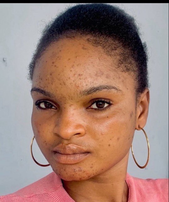 Oreoluwa✨️ 💙 tweet media