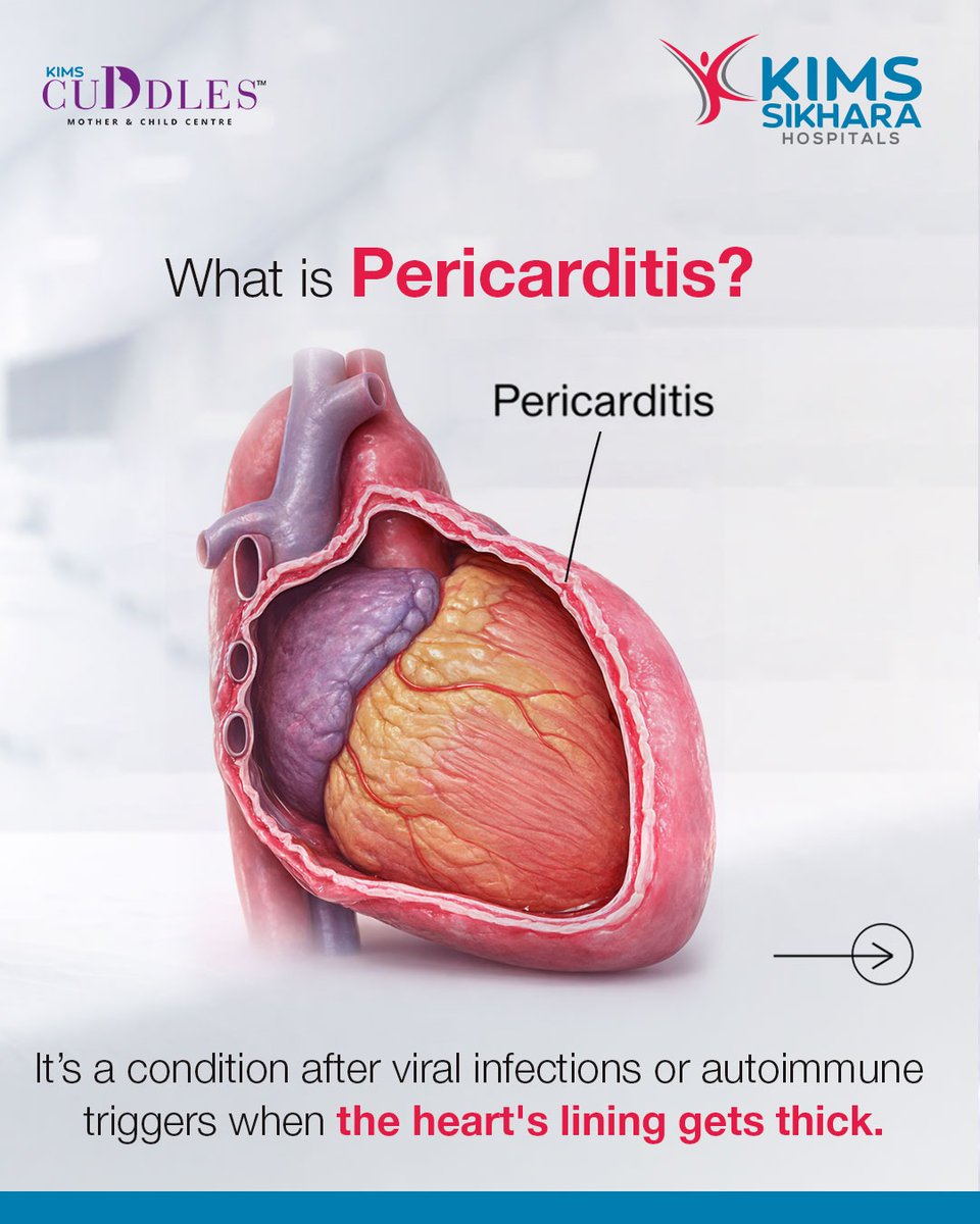 KimsSikhara's tweet image. Pericarditis is inflammation of the heart’s lining, often causing sharp chest pain. Early diagnosis and treatment are key. Don’t ignore symptoms, get diagnosed by the best cardiologists in Guntur at KIMS Sikhara. 

#Pericarditis #HeartProblems #KIMSSikhara #Cardiology