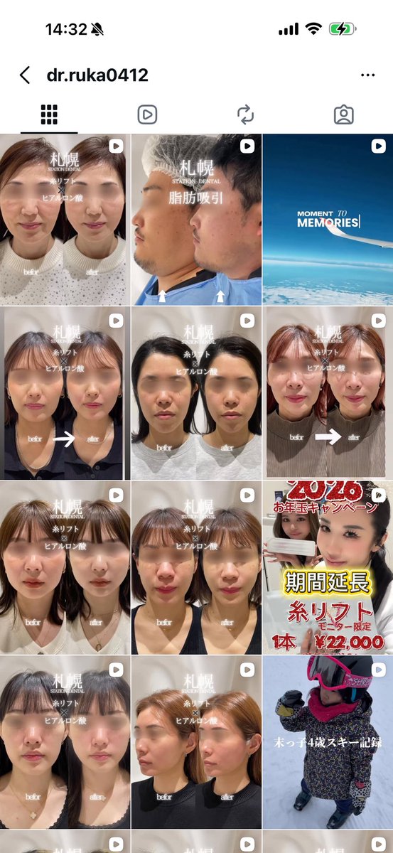 drkumoyama's tweet photo. 歯科医って脂肪吸引とか糸リフトしたら医師法違反ちゃうの？ https://t.co/JLsV2jZ4CR