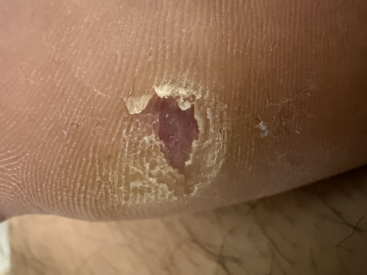 ヒロチゲ tweet media