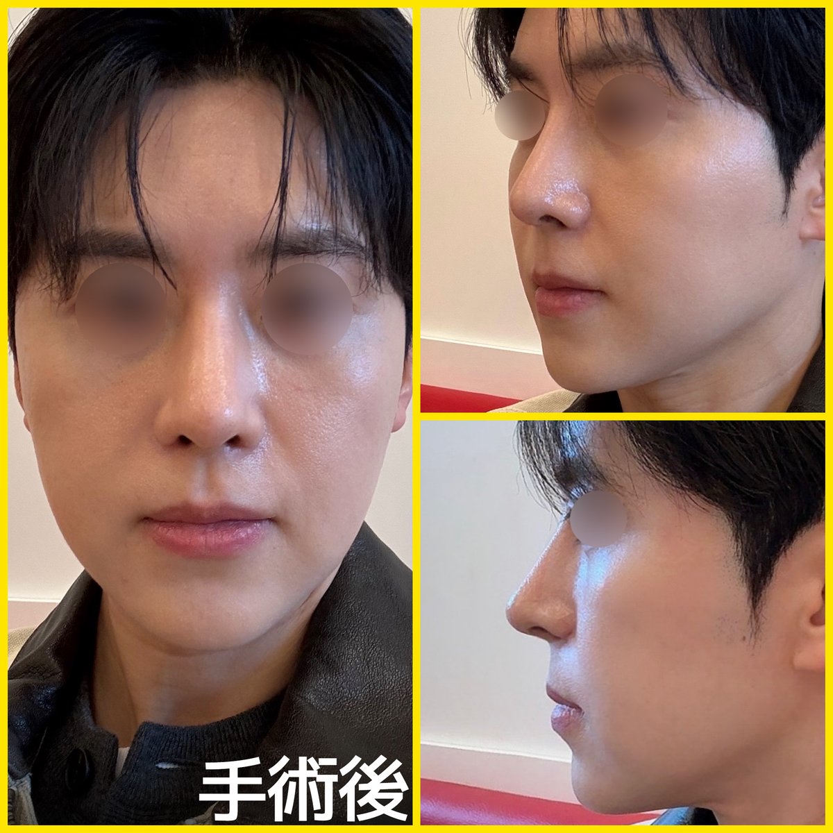 バナナ美容整形外科🍌 tweet media