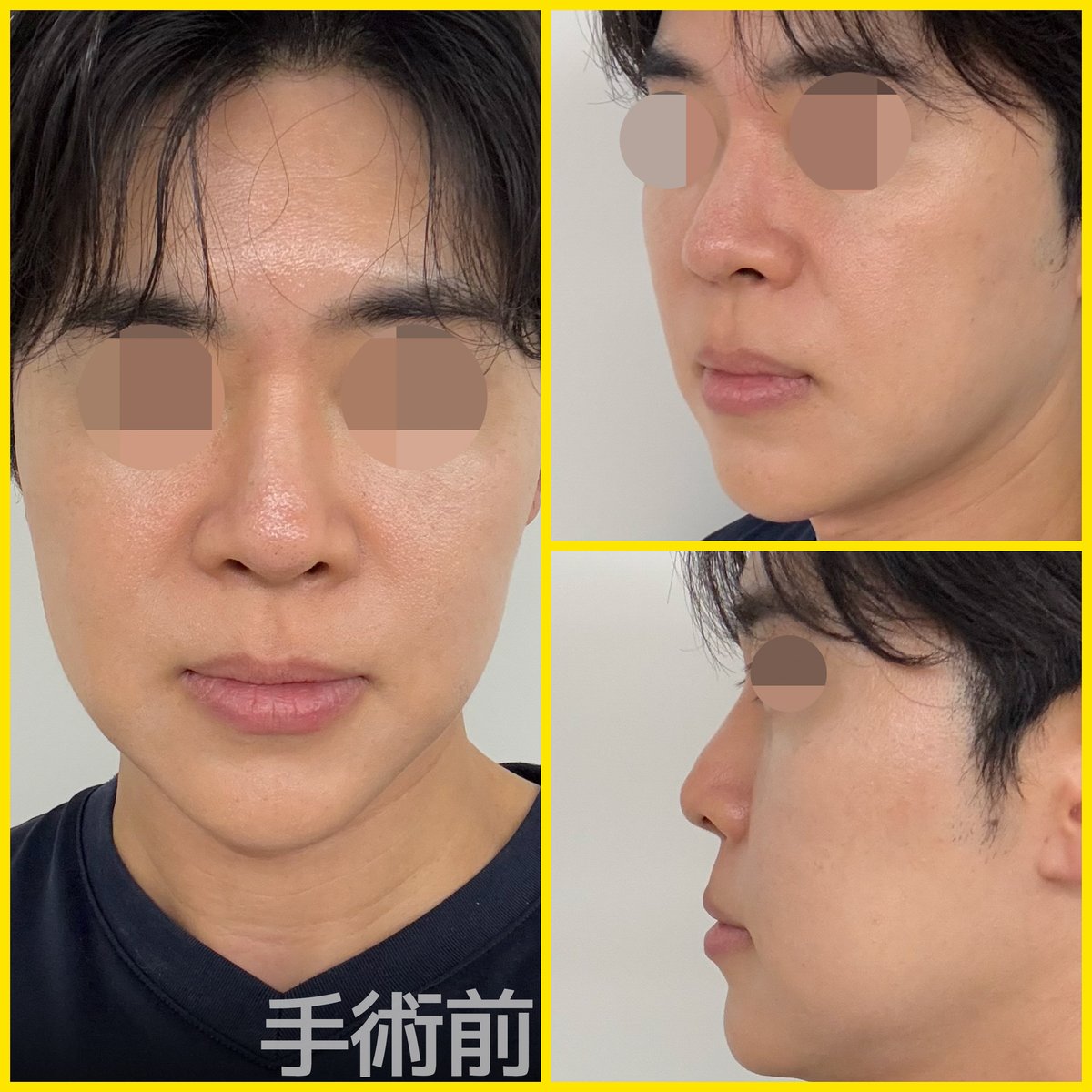 バナナ美容整形外科🍌 tweet media