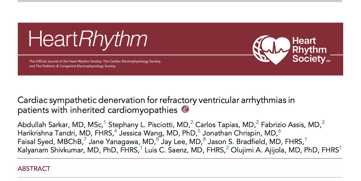 saramoscatelli7's tweet photo. ⚡ When drugs and ablation fail… target the nervous system

We are used to thinking about ventricular arrhythmias as:
👉 scar
👉 fibrosis
👉 re-entry
But this paper reminds us of something fundamental:
👉 arrhythmias are also neuro-driven
🧠 The concept:
If sympathetic activation triggers arrhythmias…
👉 why not remove the trigger?
➡️ Cardiac sympathetic denervation (CSD)
📊 In patients with inherited cardiomyopathies (HCM, ACM, DCM):
• Highly refractory population
• Failed drugs + multiple ablations
AND YET 👇
✔️ ICD shocks ↓ 61%
✔️ ~50% arrhythmia-free
✔️ 76% transplant-free survival at 4 years 
1-s2.0-S1547527125030371-main
🔥 Look at the figure (page 4):
👉 Almost every patient had fewer shocks after CSD
Not zero.
But meaningfully less
⚡ This is the real value:
Not cure.
👉 modulation

🧬 Why does it work?
Because sympathetic tone:
• lowers arrhythmia threshold
• increases triggered activity
• destabilizes substrate
👉 CSD removes that adrenergic drive

⚠️ But here’s the key nuance:
❌ It doesn’t fix the disease
❌ It doesn’t remove scar
👉 It changes the environment where arrhythmias occur
💥 And one important insight from the paper:
👉 Heart failure — not arrhythmia —
is still the main driver of outcomes
🎯 Clinical take-home

When you face:
• recurrent ICD shocks
• VT storm
• failed ablation
👉 Think beyond myocardium
👉 Think autonomic system
💬 Are we underusing neuromodulation in arrhythmia management?

#Cardiology #Arrhythmia #VT
#Cardiomyopathy #Neurocardiology
#EPeeps #CardioTwitter ⚡🫀

https://t.co/MJFqJRSZ6z