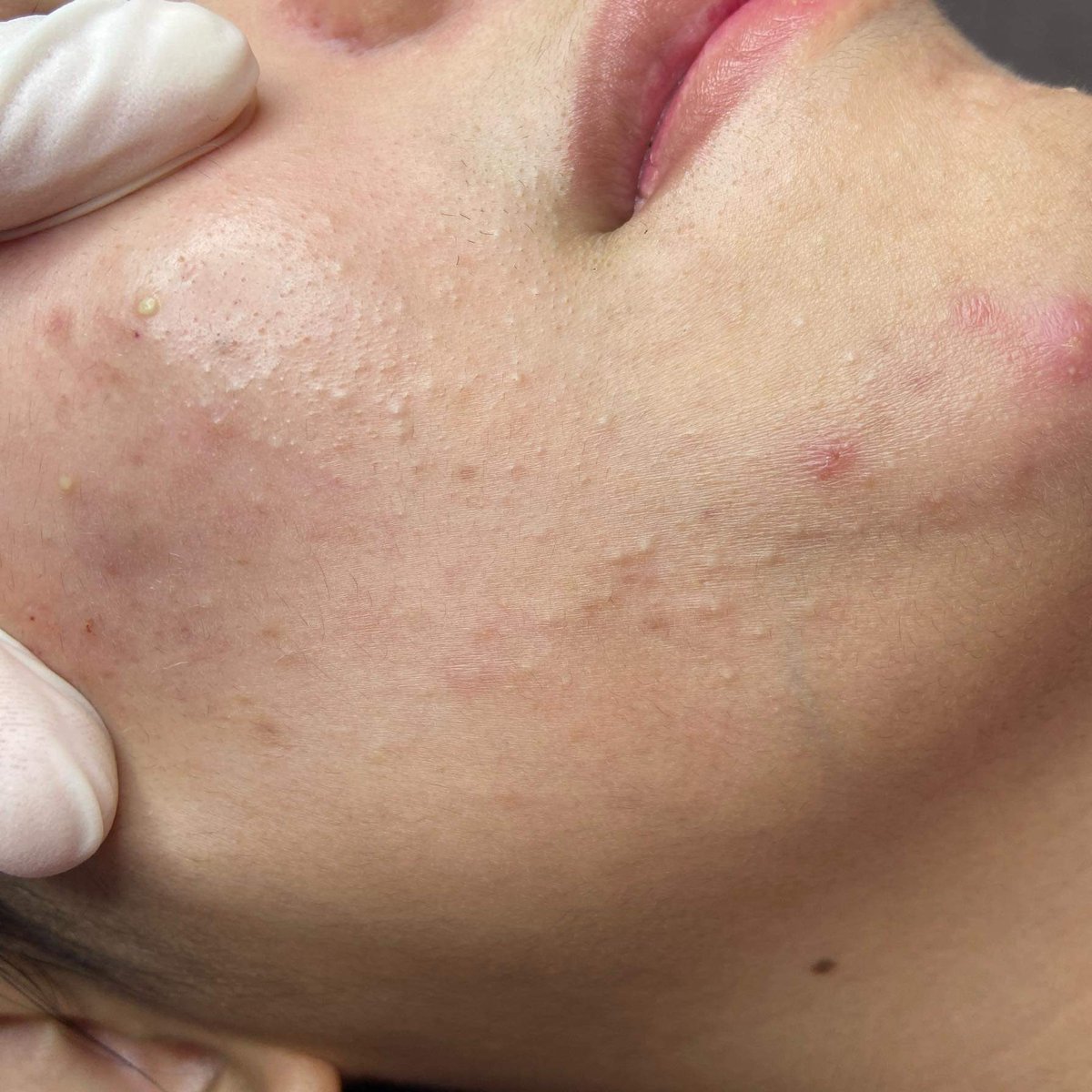 ก่อนจะสามสิบ tweet media