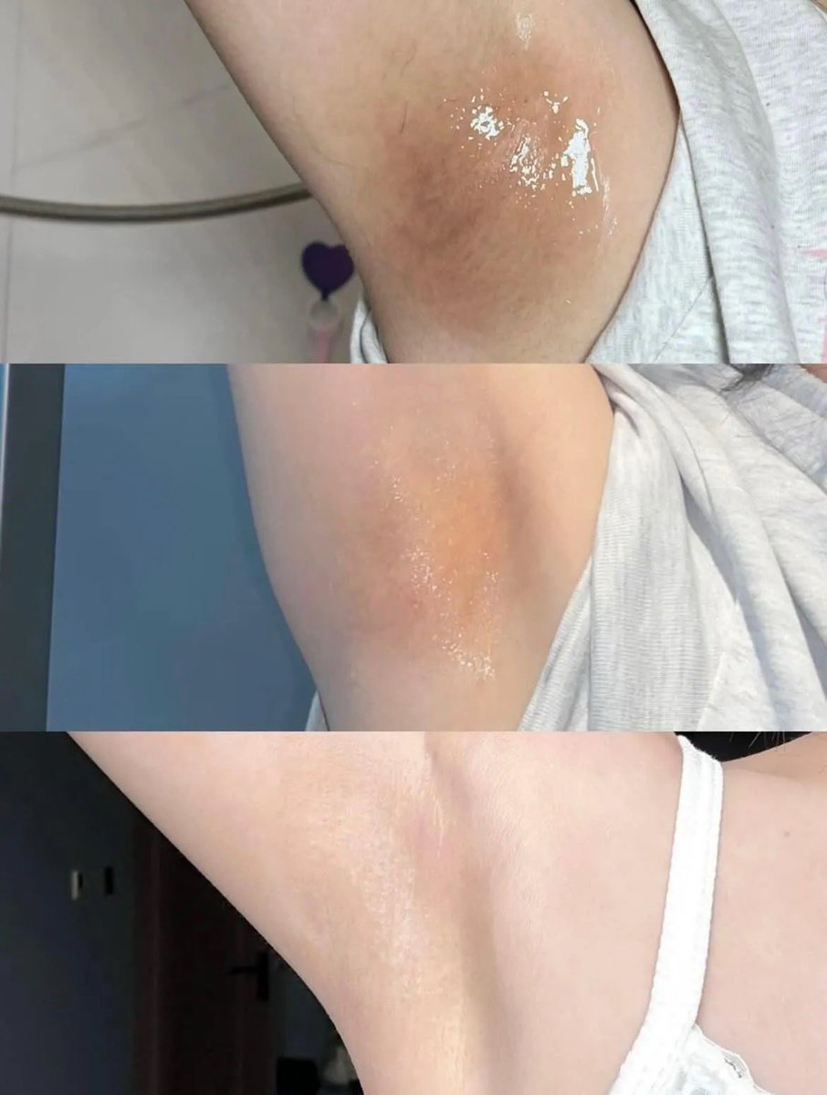 kedrickmutayi's tweet image. Qui est la personne qui a eu l'idée de ce mélange de NIVEA et Acide Glycolique en boîte bleue?

JE VEUX PRIER POUR QU'IL ENTRE AU PARADIS SANS FAIRE LA QUEUE.