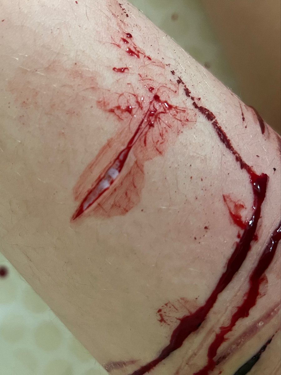 ⤷ ゛𝘳𝘰𝘣𝘺𝘯 ⋮ ⌗ ┆ tweet media