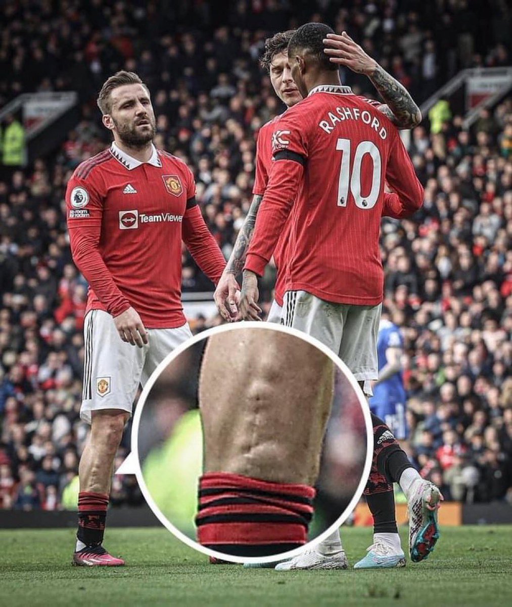 centredevils. tweet media