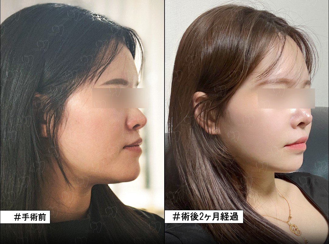 MACS口腔顎顔面外科«両顎・輪郭専門» tweet media