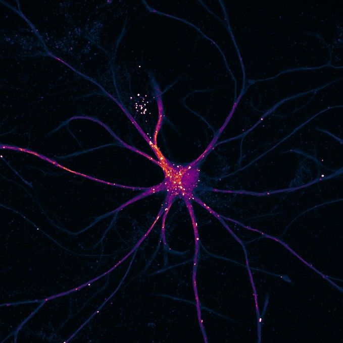 approaching a completely new domain is simple.

most people make it complicated and stay stuck.

how to actually do it:
• map the field fast → what are the core concepts, tools, and problems. don’t go deep yet, just see the landscape
• pick one small problem → not “learn