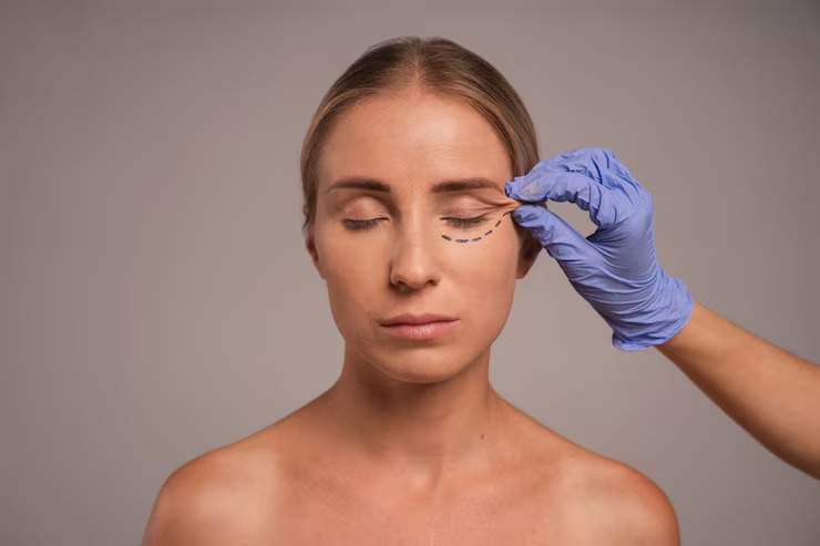 #Blefaroplastia lidera ranking global e conquista público cada vez mais jovem! #maisvocê #bbb26  faroldabahia.com.br/noticia/blefar…