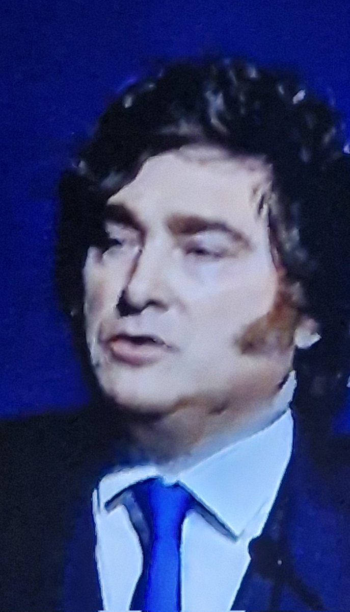 Fioravanti tweet media