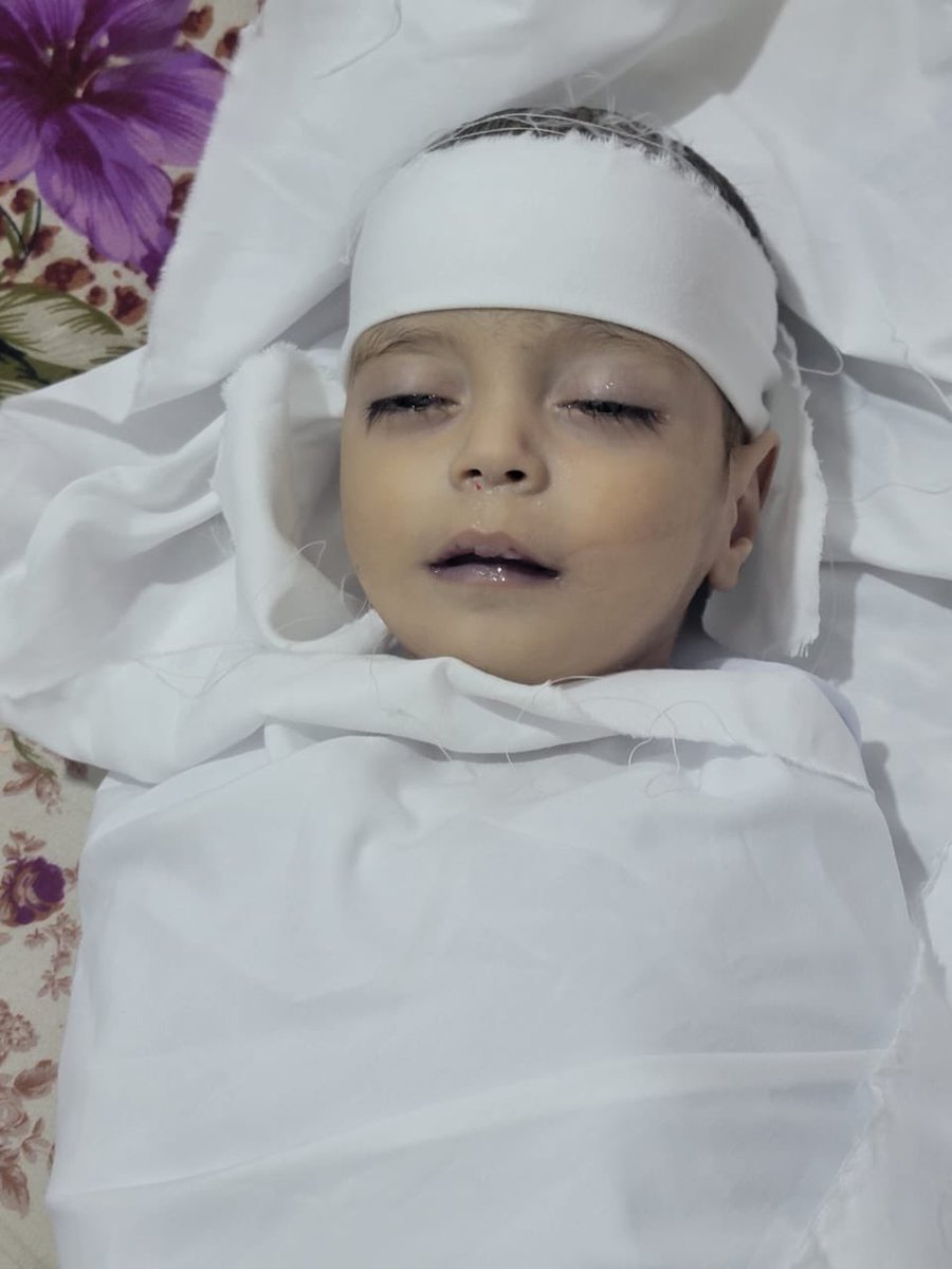 إِنَّا لِلَّٰهِ وَإِنَّا إِلَيْهِ رَاجِعُونَ

With hearts weighed down by grief, we share that the beloved Yemeni child, Mustafa, has returned to Allah.

In this painful moment, we also want to take a step back and sincerely thank every single person who stood with Mustafa during