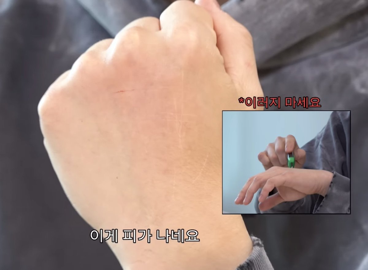 이거는 손에 이렇게 뭐  해도.............피가 나네요....🙄 ㅋㅋㅋㅋㅋㅋㅋㅋㅋㄲ