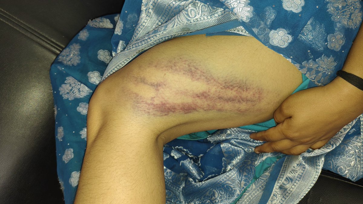 triveji's tweet photo. व्याख्या की करतूत 20 दिन बाद भी पुलिस मौन @PoliceRajasthan @RajPoliceHelp @BhajanlalBjp @narendramodi @BhajanlalBjp @DholpurPolice @ https://t.co/G4WfFSNlJz