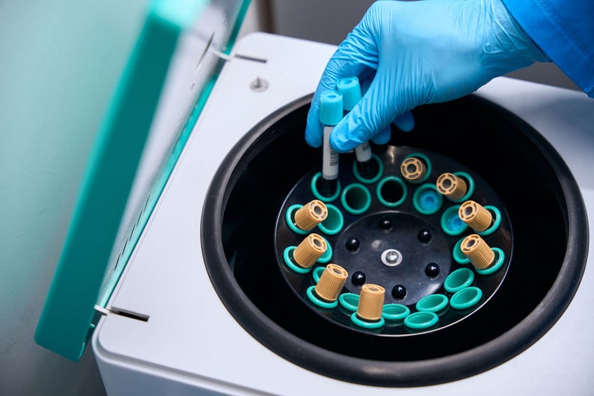 iowafertility's tweet image. Better IVF Outcomes With Freezing And Screening
Embryo freezing allows for more time to perform genetic screening. Can this approach increase the chances of IVF success?
#ivf #embryofreezing #midiowafertility
zurl.co/XaUFh