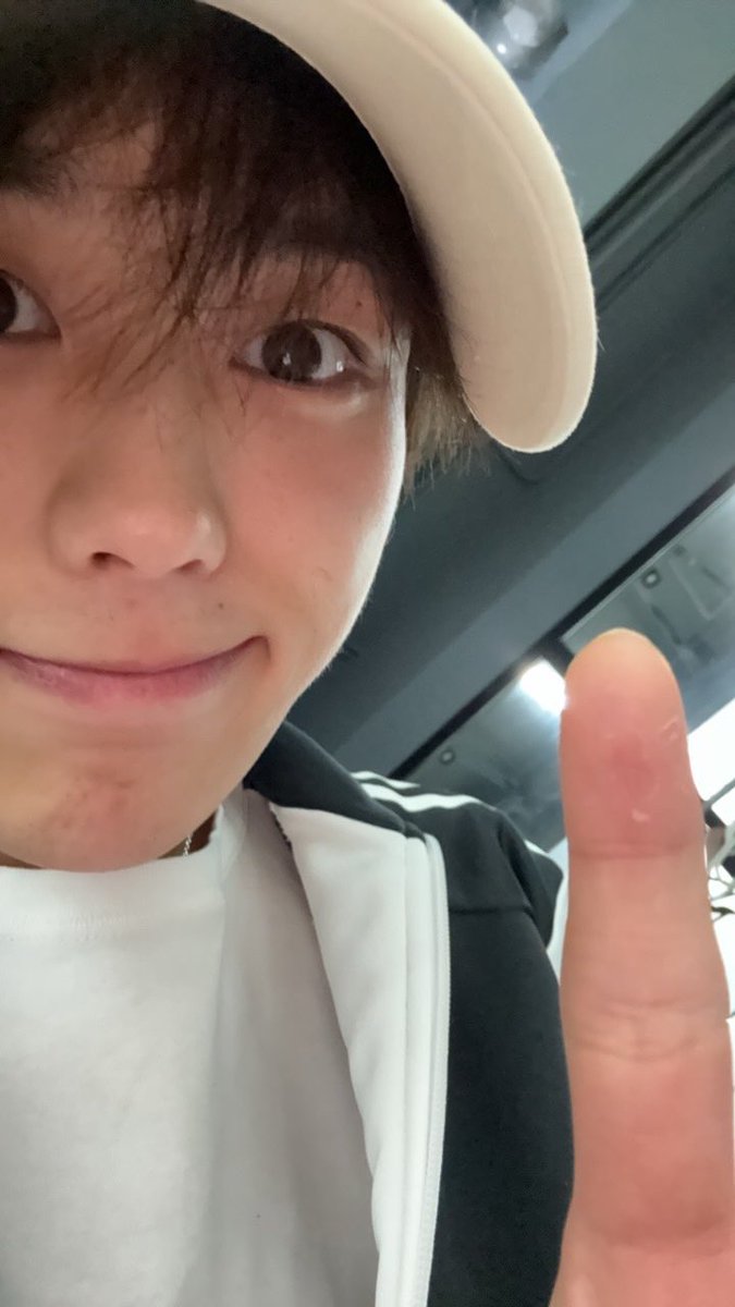 hxnwen's tweet photo. 🐶: come dance
🐶: about video calls, i'm looking for opportunities, but there are relatively few. i also want to do it.
🐶: my palms get like this during this season (picture).
🐶: 😭 https://t.co/JjpAixzoFe