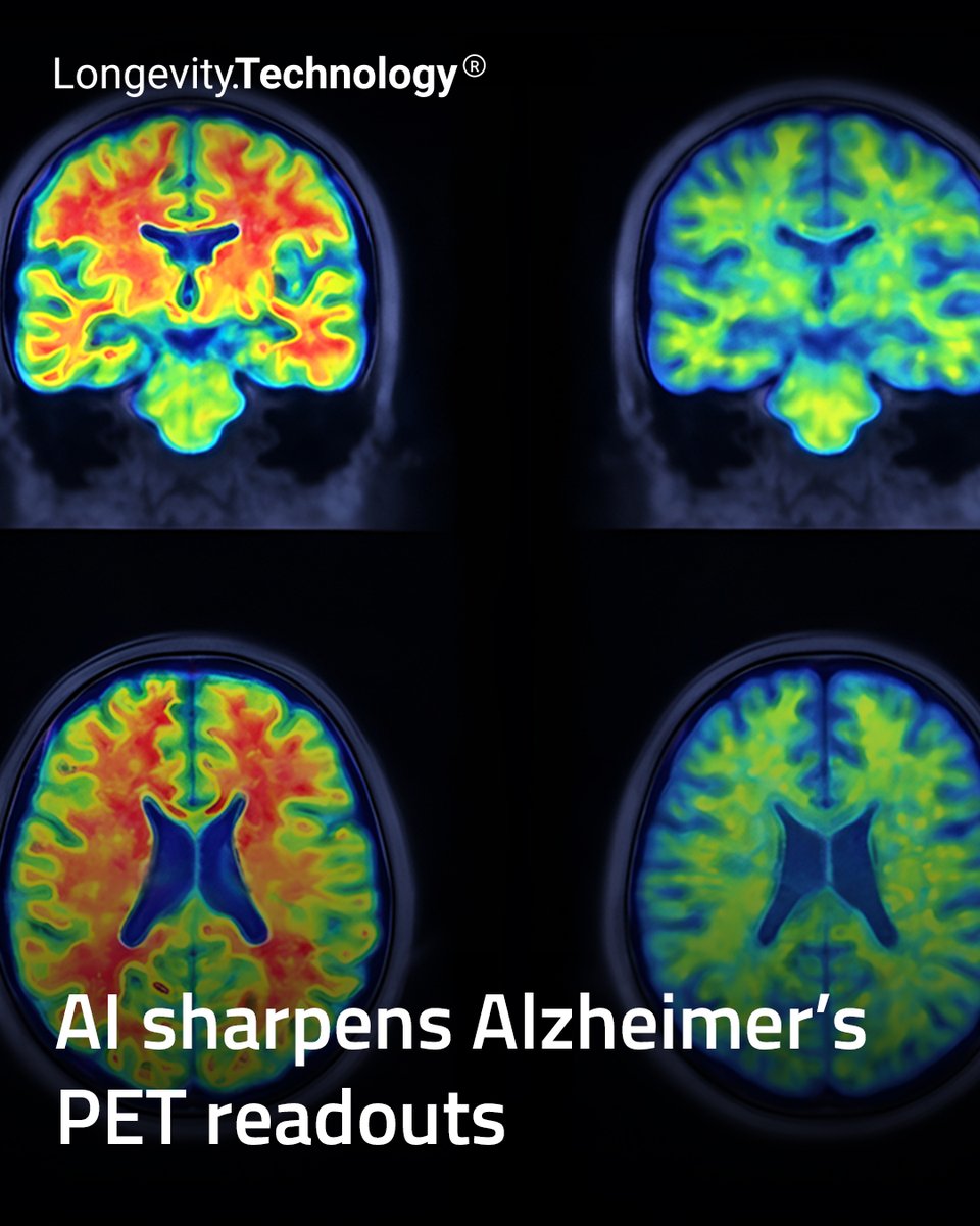 LongevityTech's tweet image. AI sharpens Alzheimer’s PET readouts, improving diagnostic precision as imaging becomes central to earlier detection.
ㅤ
Link in bio.
ㅤ
#longevity #ai #alzheimers #healthspan #diagnostics