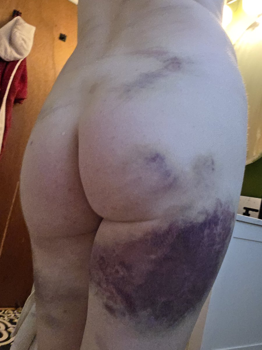VictoriaGleeXXX's tweet photo. https://t.co/VCQUEJMKvc