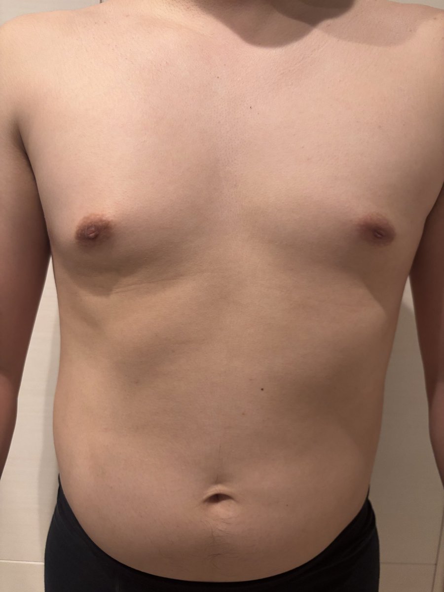 debudiet365's tweet image. #Day15 ワンパンマンチャレンジ

2週間終わって
少し気が抜けた

でもまだ途中

目標には全然届いてない

ここからが本番

▶検証中
ワンパンマンだけで痩せるのか
フォローで見届けてください

#ダイエット #筋トレ #ボディメイク  
#ダイエット記録  #パパダイエット  
#ワンパンマンチャレンジ