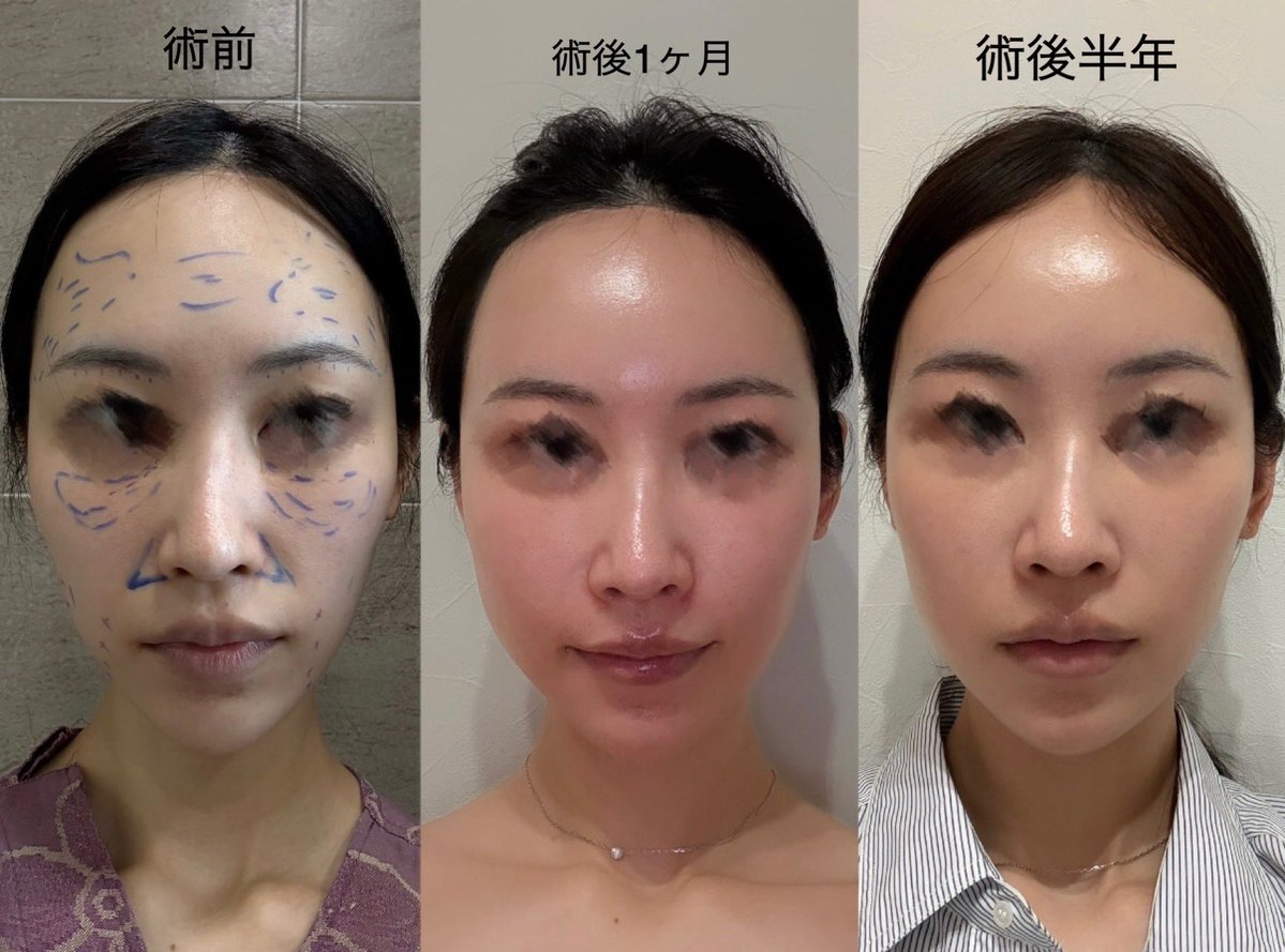 たこちゅ🐙 tweet media