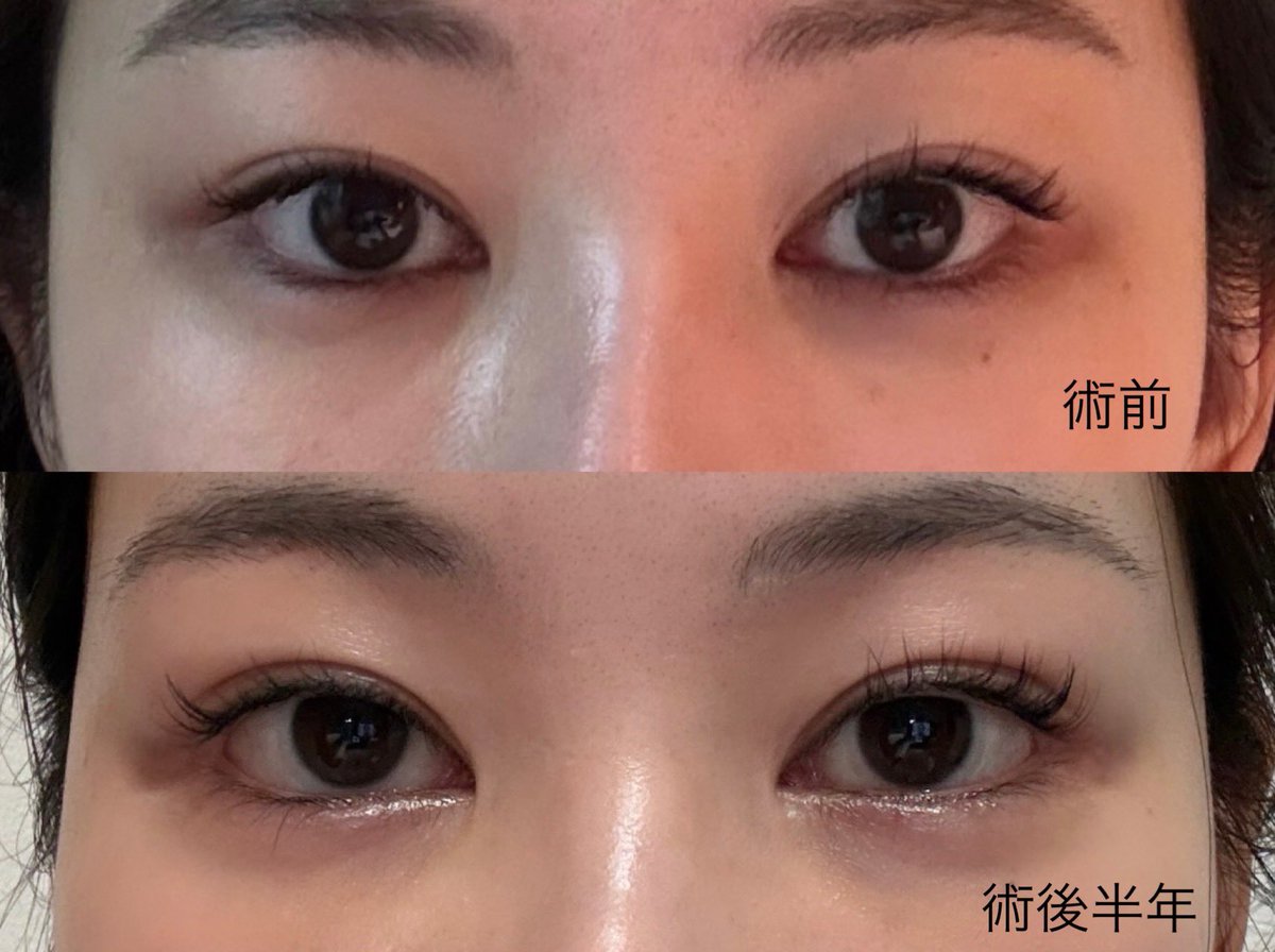 たこちゅ🐙 tweet media