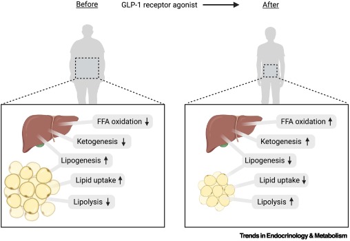 Trends_Endo_Met's tweet image. Online Now:  A fuel partitioning perspective on appetite suppression by GLP-1 receptor agonists dlvr.it/TS32Gk #trends #endocrinology #metabolism