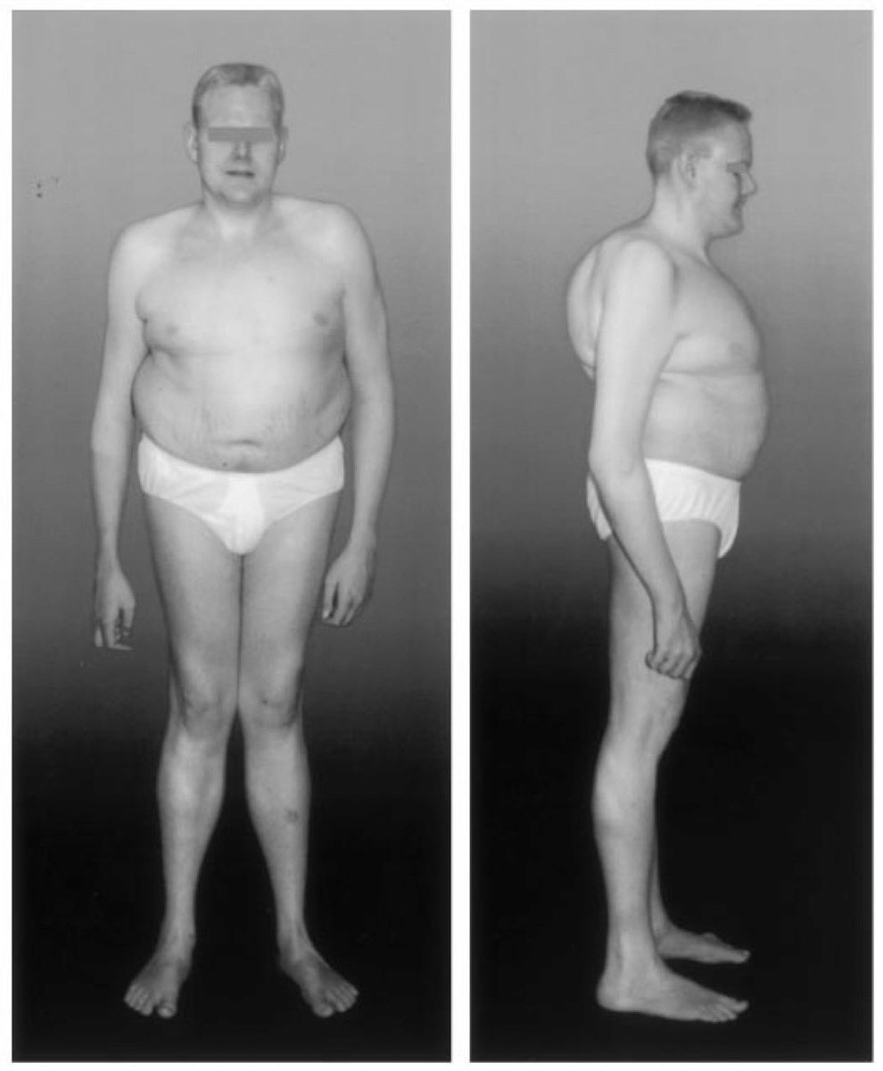 Lancesico 🇱🇨 tweet media