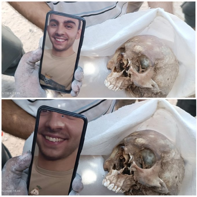 RamAbdu's tweet image. They identified him by his teeth!
Stories that make your hair stand on end have happened in Gaza.
We will never forget the Israeli genocide, no matter how much time passes.