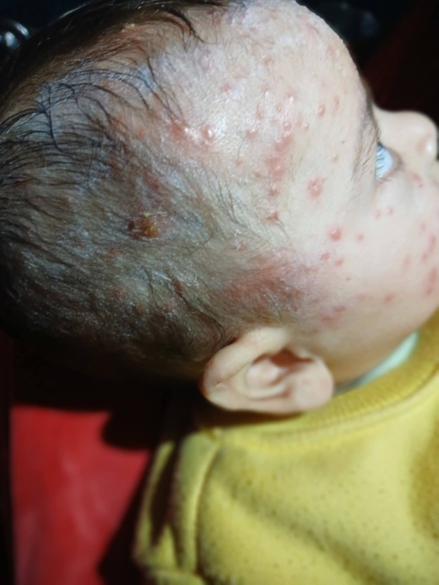 Yousef in Gaza 🇵🇸 tweet media