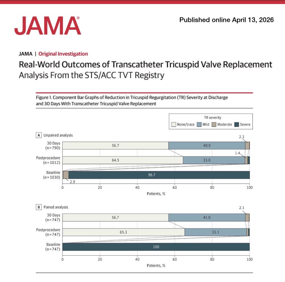 ZainKhalpey's tweet image. Transcatheter tricuspid valve replacement shows high success, reduced regurgitation, and improved patient outcomes in real world data. 

Promising direction for structural heart care. 

jamanetwork.com/journals/jama/… 

#MedTwitter #Cardiology #MedTech #HeartHealth