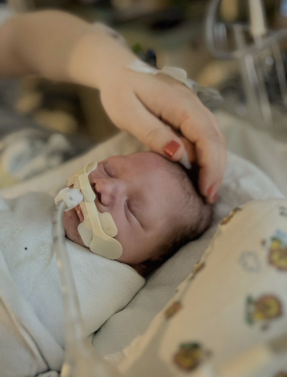 MomtoEandP's tweet photo. I’m crying happy tears saying this, but HAPPY BIRTHDAY to my incredible Popstar who is 3 today! The odds she’d make it this far were incredibly slim, but look at her! From the birth photo to the 1st birthday, then her 2nd birthday to now, you see so much growth. And not just physically. She has grown in ways even I didn’t expect. She’s so funny. A true jokester she is. She is trying so hard to say I love you and has even started trying out potty training. She just graduated from Early Intervention this week and has a spot on Saturdays at our local Special Olympics. One thing different this birthday is she’s walking and running and getting into everything, which I’m actually so happy about and I think it’s a blessing to be exhausted everyday from her and her sister just finally being kids together. I can’t wait to see what this next year has in store for her. If it’s anything like this last year she is going to thrive. I love you more than I can put into words, Happy Birthday Poppy Suzette. I’m so lucky you call me Mama. 🧁🥳💖