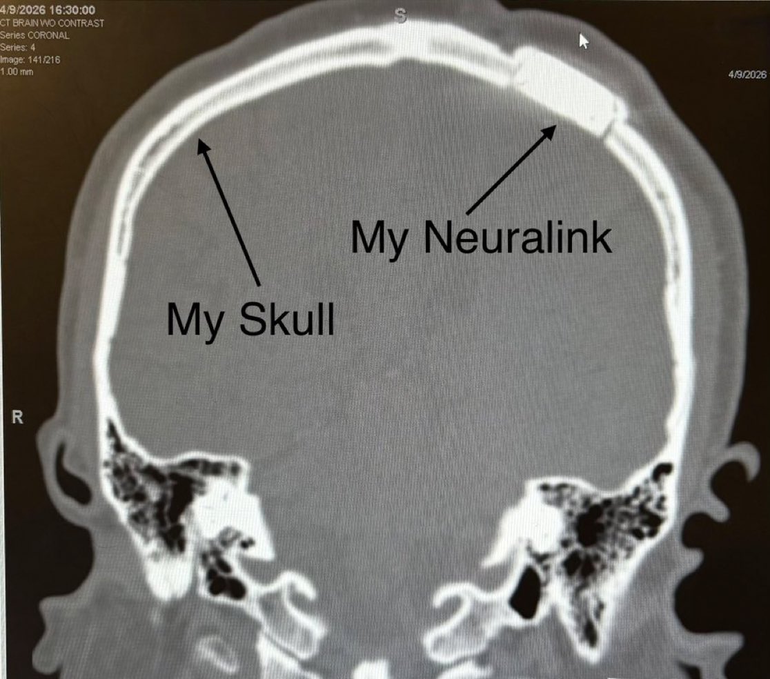 TeslaXander tweet media