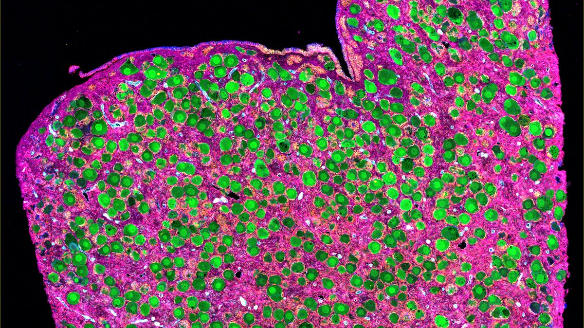Human BioMolecular Atlas Program (HuBMAP) tweet media