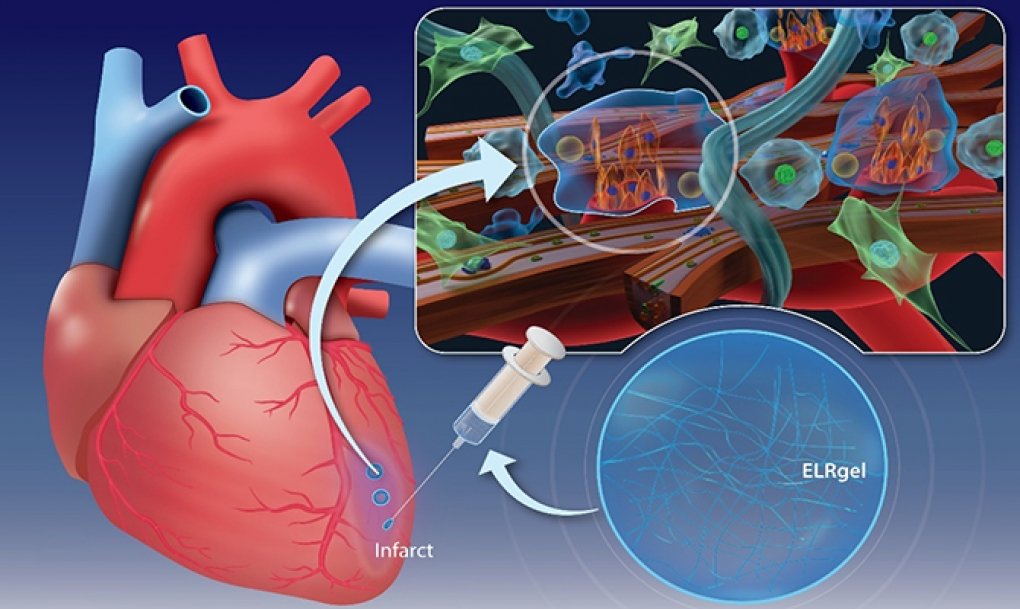 NewsDayMundo's tweet image. De paliar a regenerar. 🫀 
La medicina cardiaca está dando un salto histórico: los nuevos hidrogeles bioactivos no solo desbloquean arterias, sino que reparan el tejido dañado tras un infarto. 
Adiós a la cicatriz, hola a la recuperación funcional. #Biotech #Salud #Innovación
