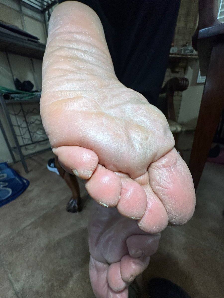 THE STINKY👣 QUEEN Sz11 tweet media